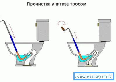 A kép egy sémát mutat be az elzáródás megszüntetésére egészségügyi kábel segítségével. A kép egy sémát mutat be az elzáródás megszüntetésére egészségügyi kábel segítségével.